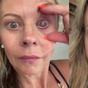 La mujer decidió contar su historia para prevenir sobre el cuidado con los lentes de contacto.