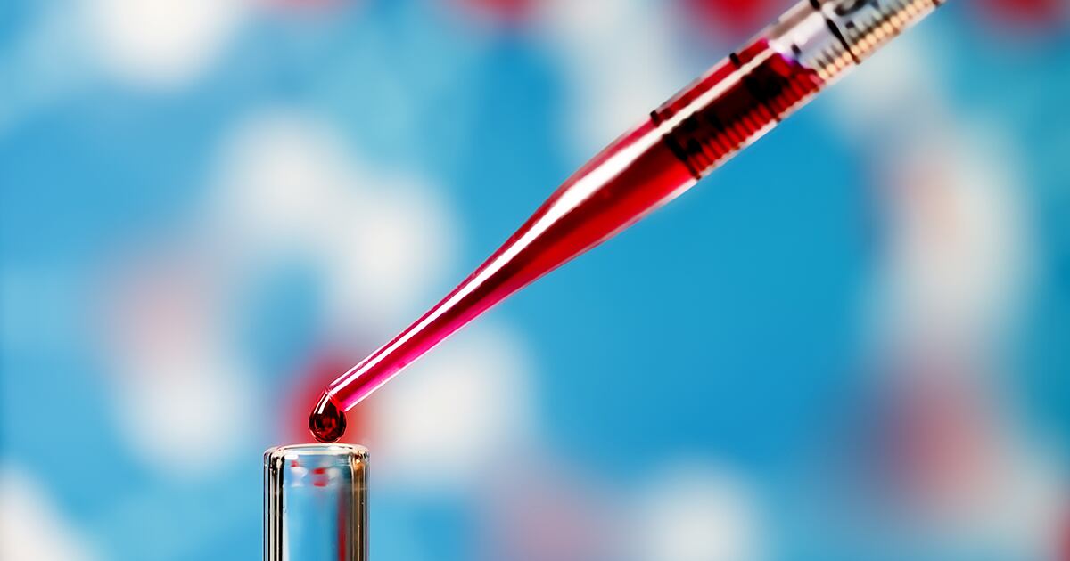 El análisis captura células cancerosas o ADN que los tumores envían hacia la sangre, en lugar de tomar tejido del mismo tumor.