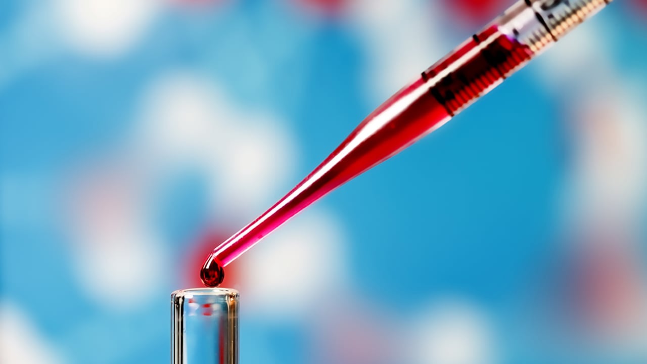 El análisis captura células cancerosas o ADN que los tumores envían hacia la sangre, en lugar de tomar tejido del mismo tumor.