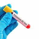 Potasio en la sangre