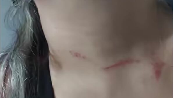 El agresor habría intentado asesinar a la víctima, ahorcándola.