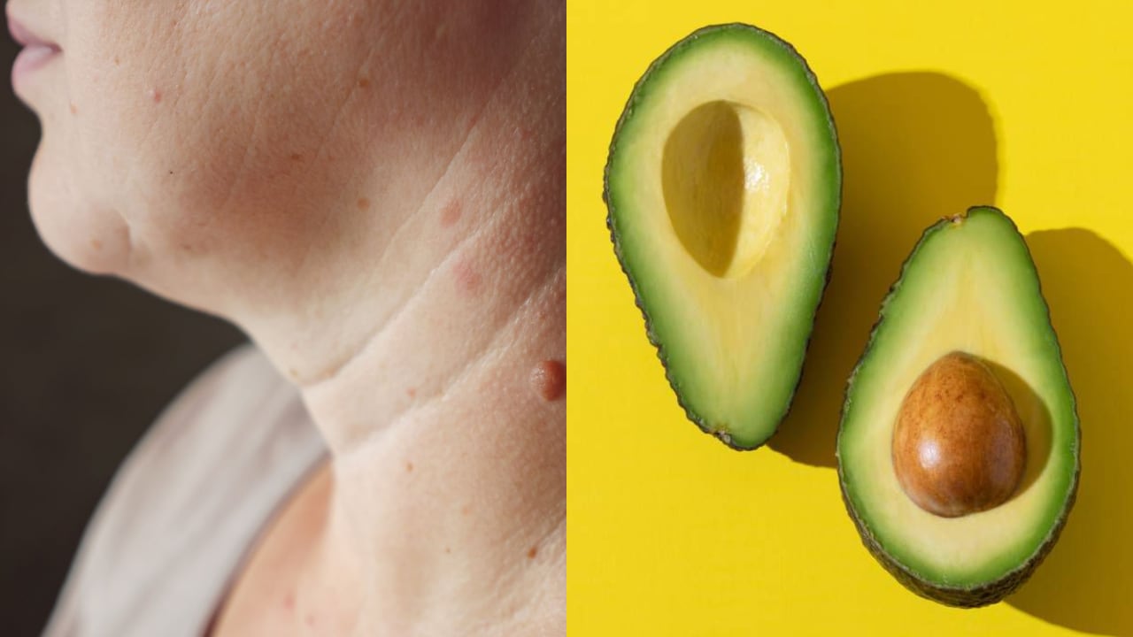 Las arrugas son inevitables, sin embargo, se pueden reducir con productos naturales.