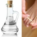 Los hongos en las uñas de los pies se consideran como una infección común. Foto: Getty Images. Montaje SEMANA.