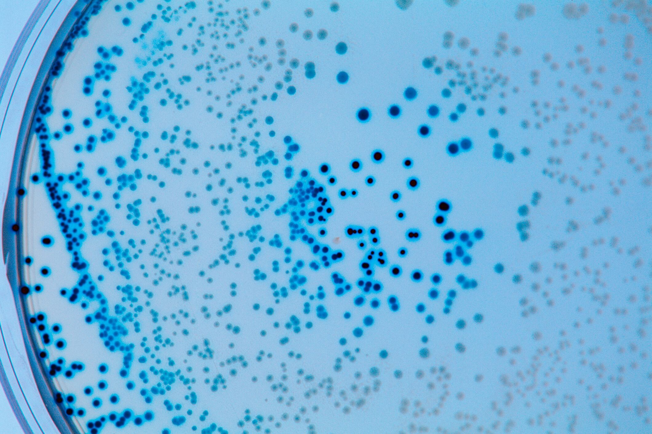 Foto de referencia sobre bacterias