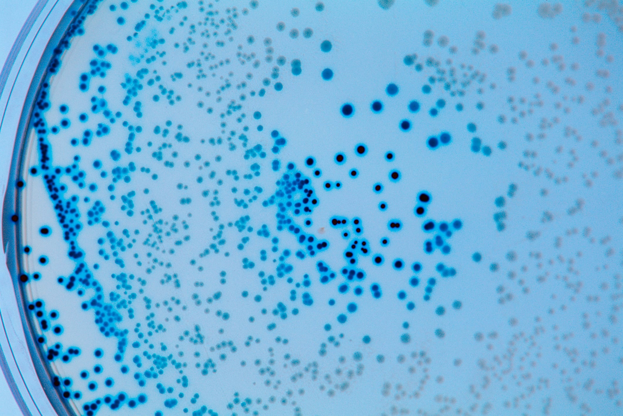 Foto de referencia sobre bacterias