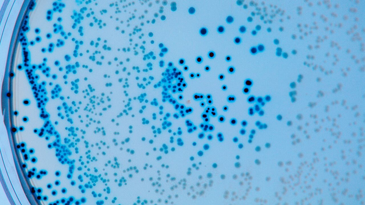 Foto de referencia sobre bacterias