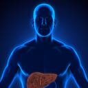 El hígado graso si no se ataca puede derivar en cirrosis.