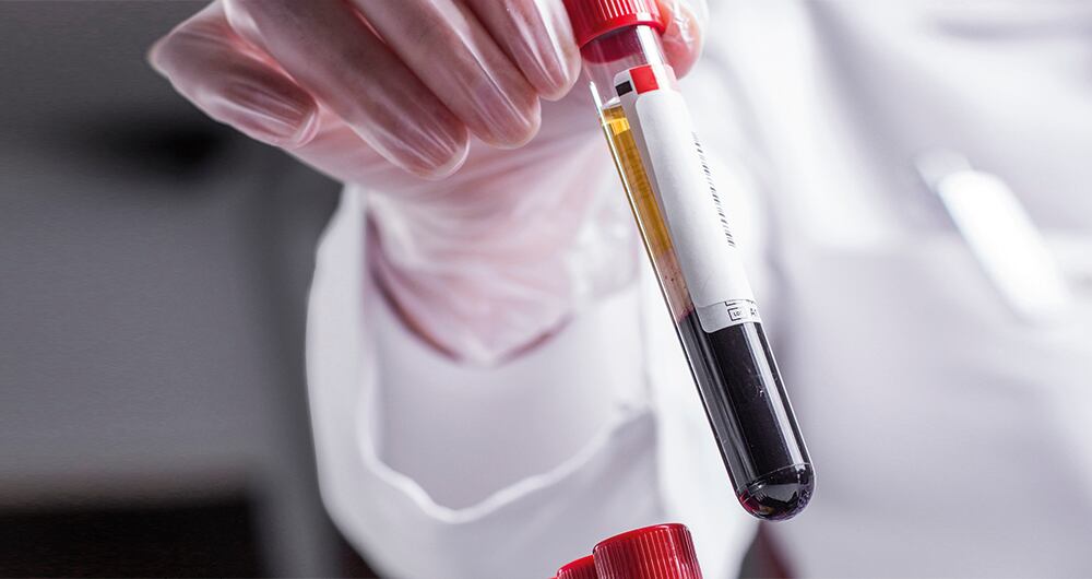 Cansados al despertar_3