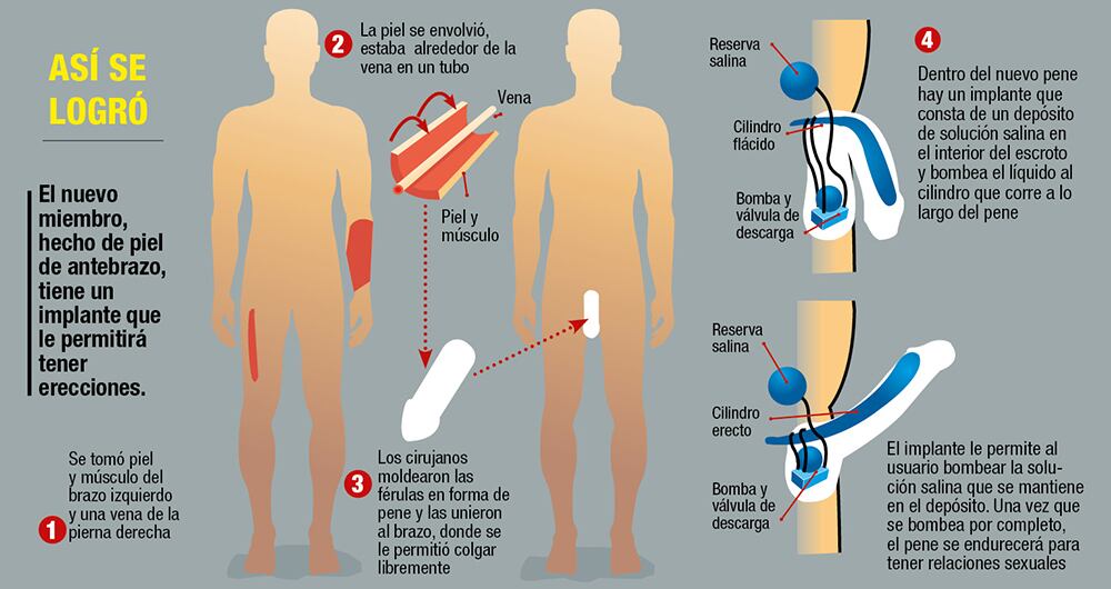 Sin pene ni gloria_2