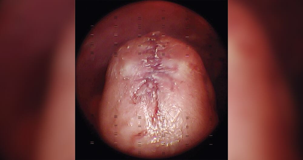Durante tres horas y media, la precisión y rigurosidad fueron determinantes para concluir una exitosa cirugía. 