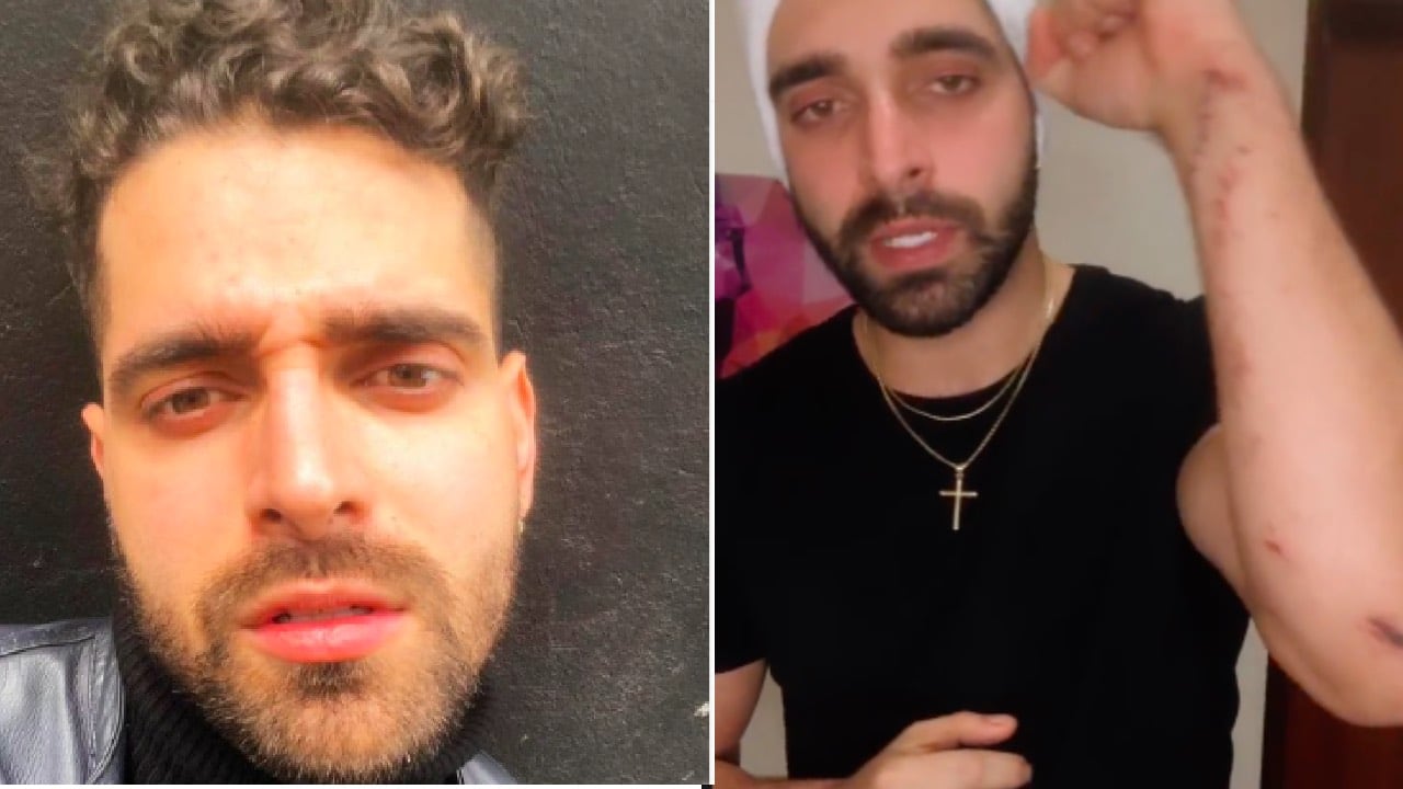 La sustancia que le fue suministrada sin su consentimiento fue la mescalina, sin embargo, no revela si se la dieron las personas con las que él estaba o algún desconocido.