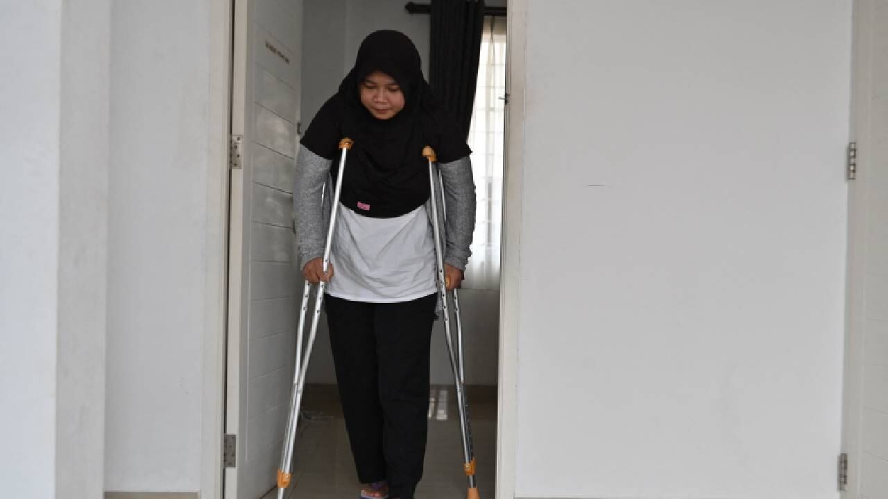 Las secuelas que le quedaron a la joven indonesia no son solo físicas.