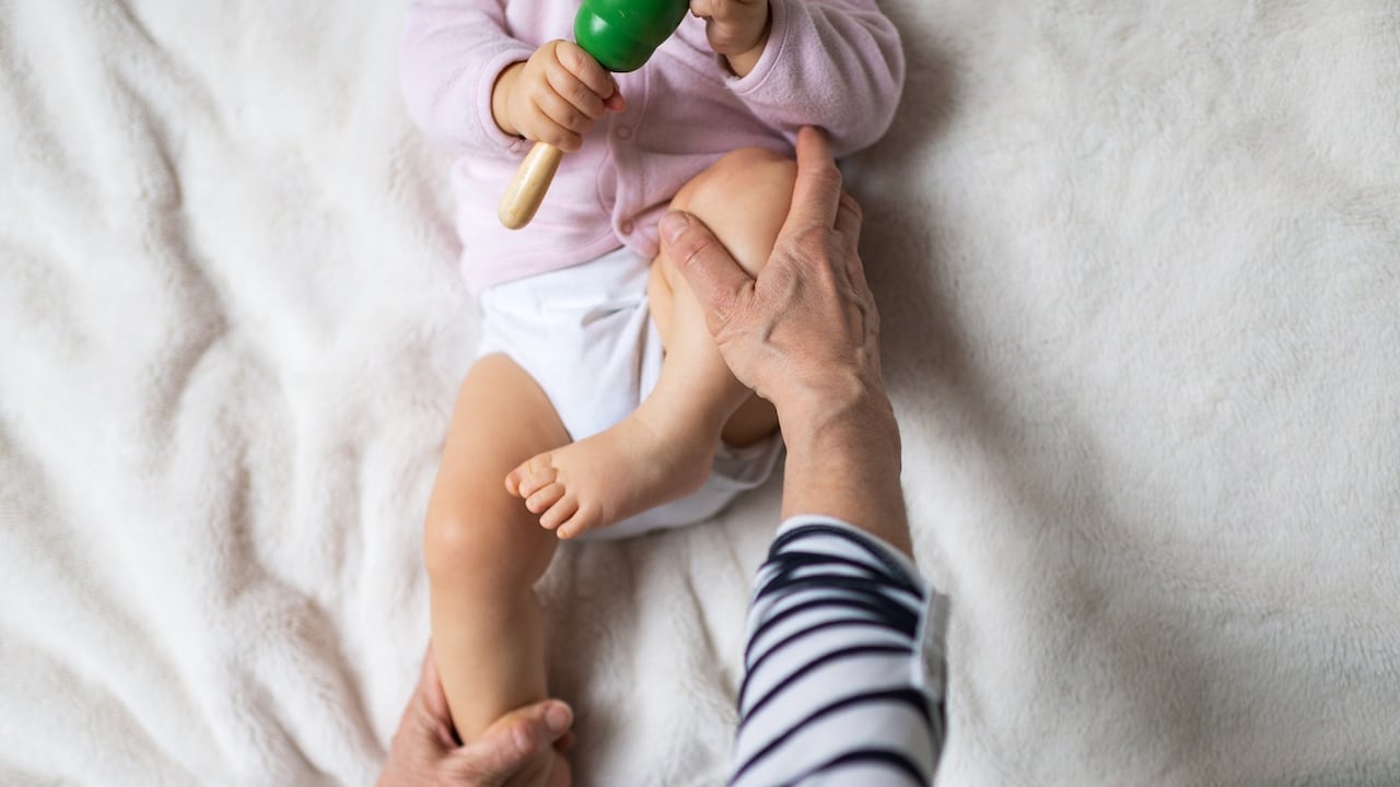 La displasia de cadera se da normalmente en los recién nacidos.