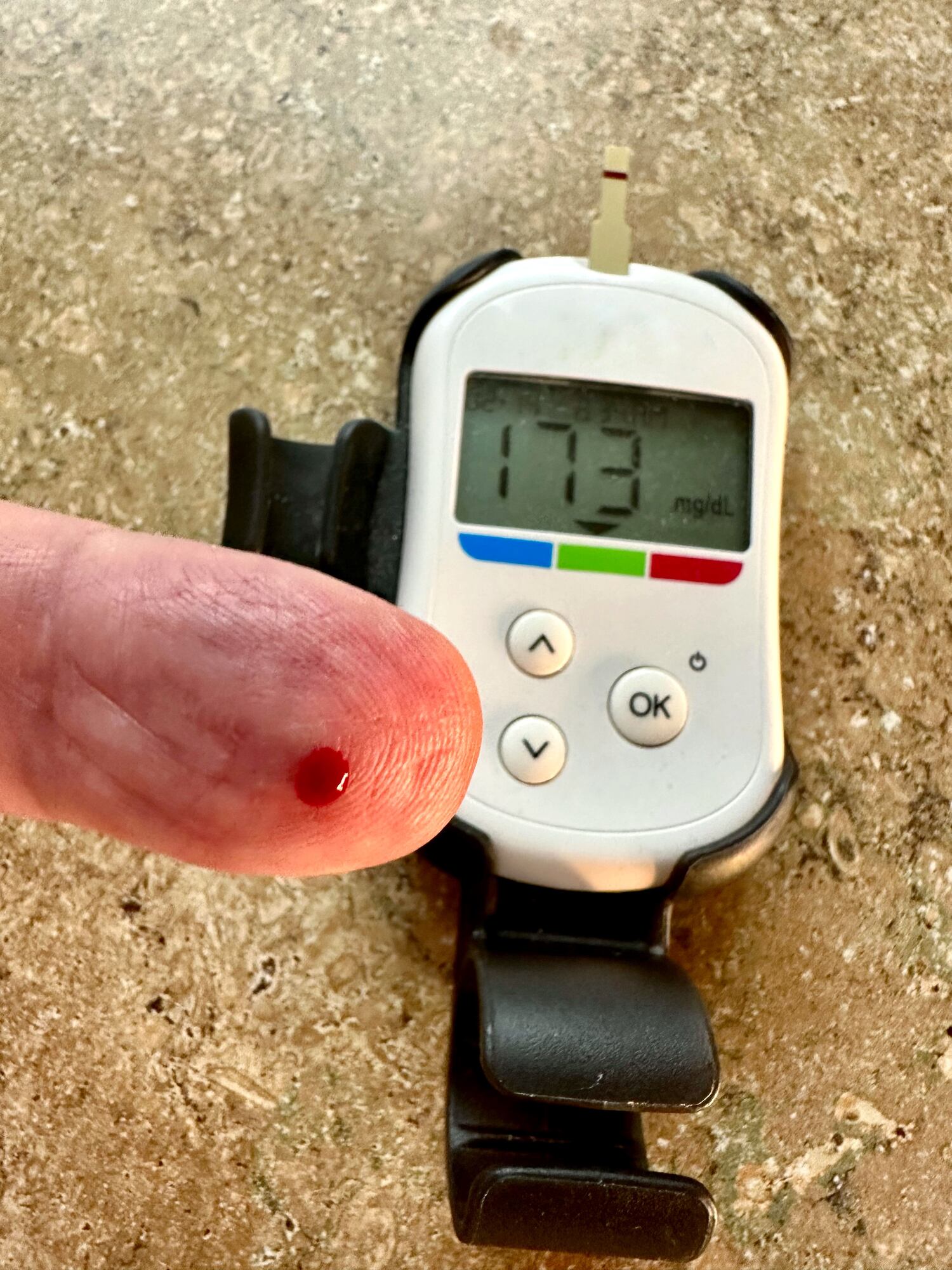 Azúcar en la sangre