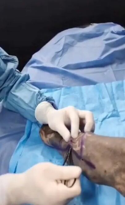 Modificaciones corporales de Víctor Hugo Peralta.