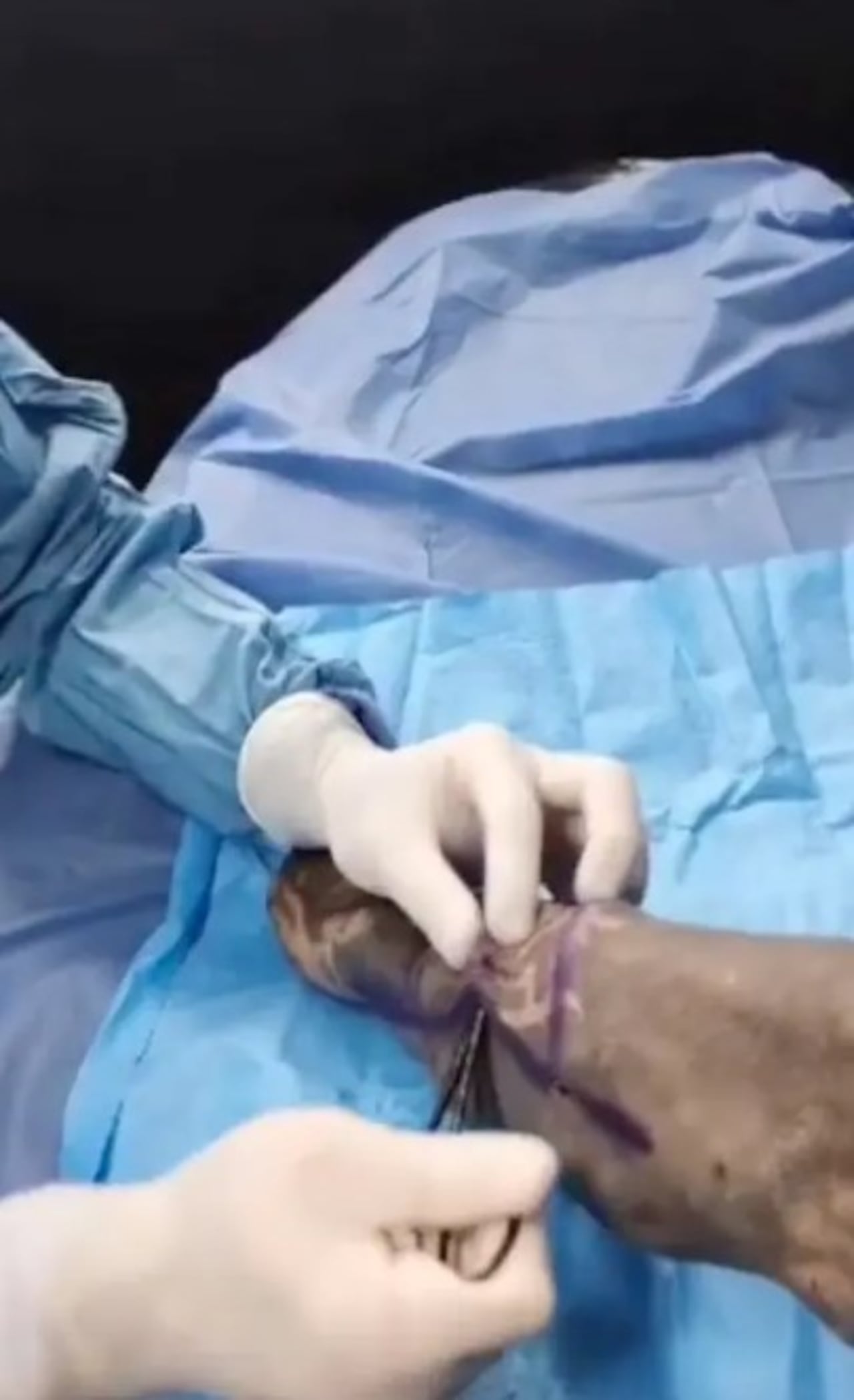 Modificaciones corporales de Víctor Hugo Peralta.