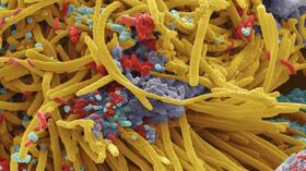Las imágenes fueron captadas con un microscopio electrónico de barrido o MEB.