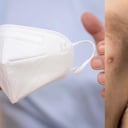 Viruela de Mono - Tapabocas