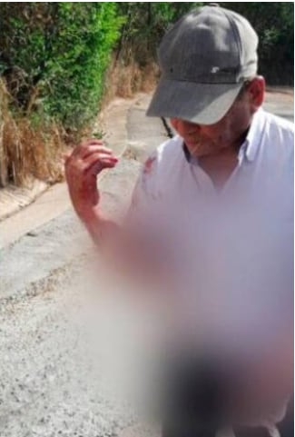 El afectado es un taxista de la tercera edad.