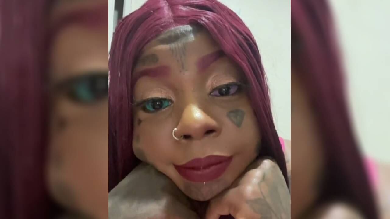Mujer dijo estar arrepentida por tatuarse los ojos.