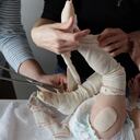 Infosalus.- El rechazo social, un dolor que llega a superar al de las heridas en los pacientes con la piel de mariposa
(Foto de ARCHIVO)
14/9/2010