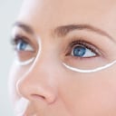 Las ‘patas de gallo’ comienzan a aparecer y terminan convirtiéndose en una de las imperfecciones en el rostro más comunes.