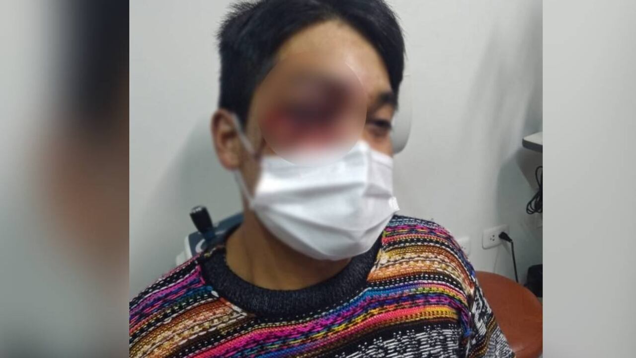 Mala atención médica y silencio frente al caso de joven afectado por proyectil de la policía en protestas en Perú