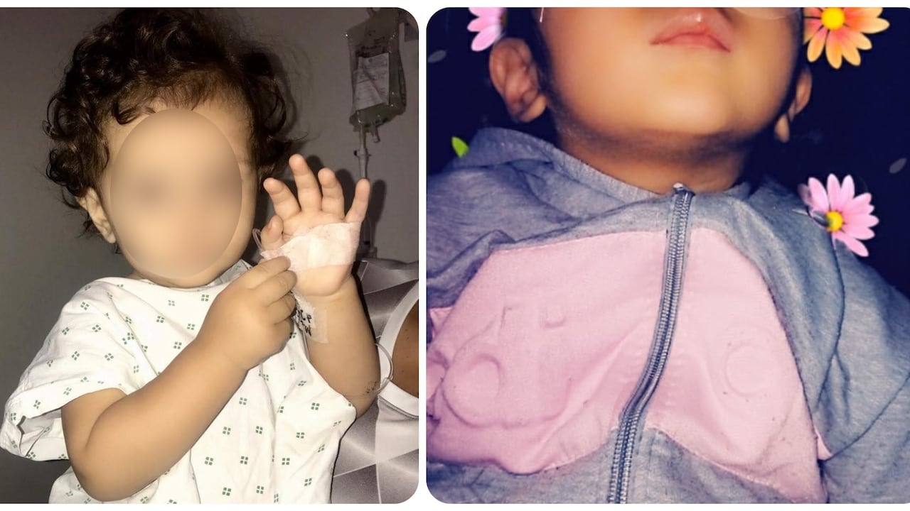 El drama de la pequeña Antonella, quedó ciega y le diagnostican poco tiempo de vida