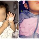 El drama de la pequeña Antonella, quedó ciega y le diagnostican poco tiempo de vida