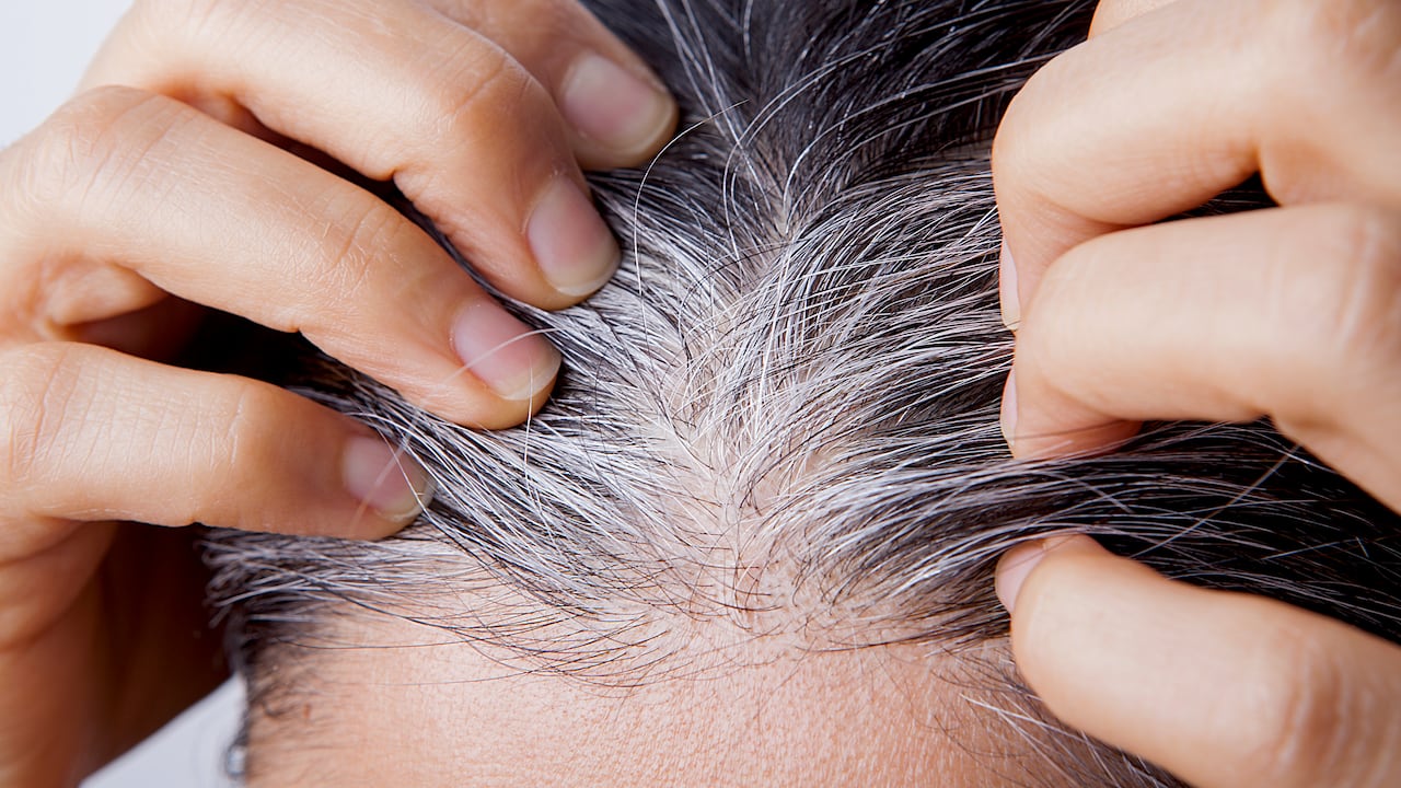 Las canas son un signo de envejecimiento.