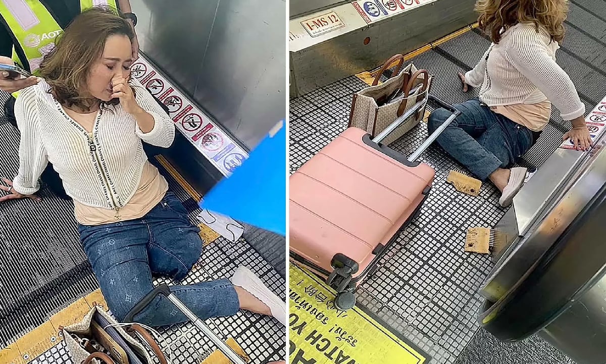 Las autoridades de emergencia del aeropuerto determinaron que para sacar a la mujer, debían amputar su pierna izquierda.