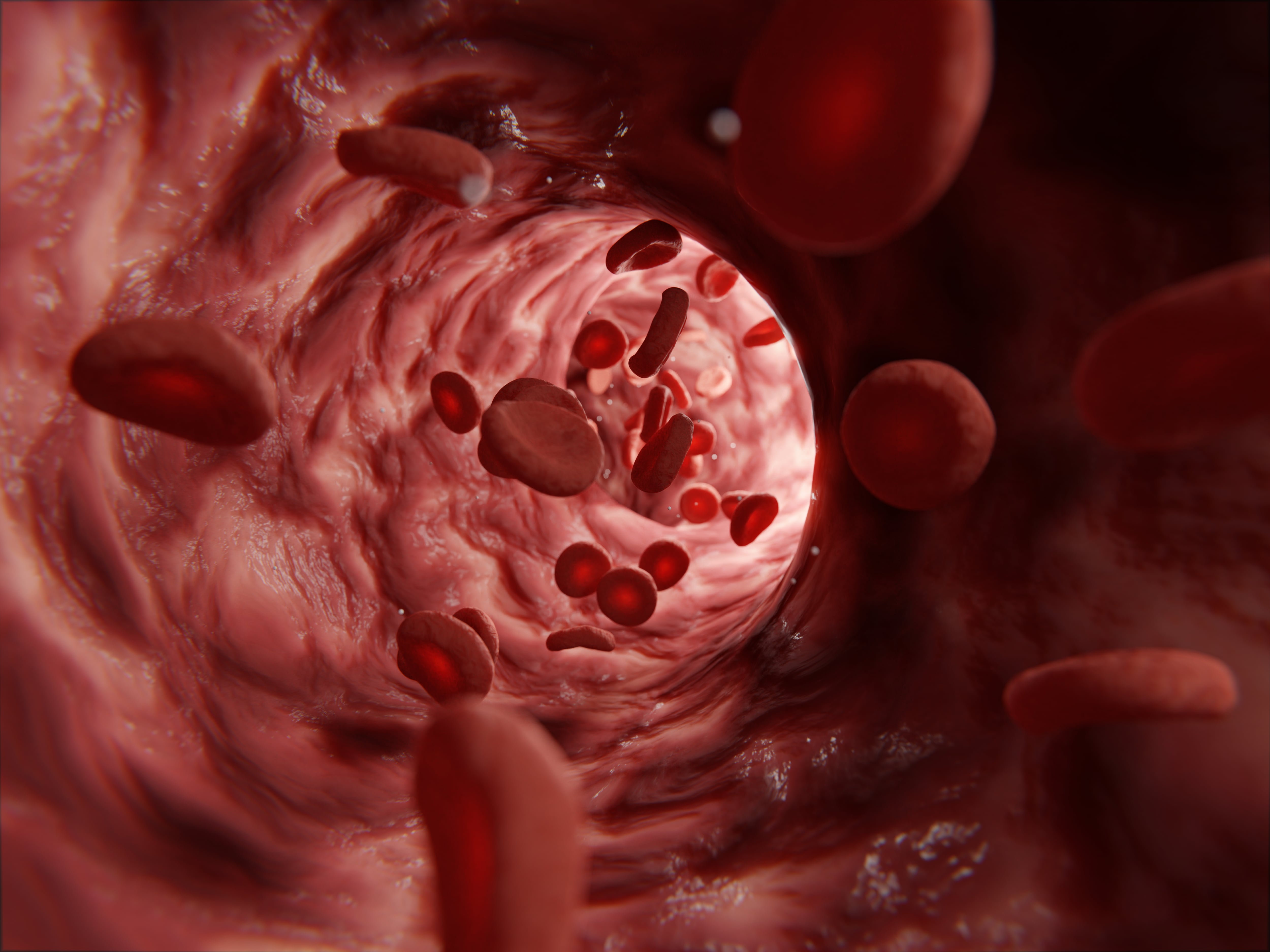 Mantener limpias las arterias es fundamental para tener una buena salud.