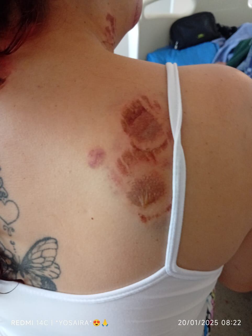 A la cárcel el hombre que, en Bogotá, atacó a mordiscos a su esposa y la dejó encerrada