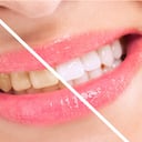 Algunas frutas oscuras pueden generar manchas en los dientes si se no se realiza un buen aseo bucal luego de ingerirlas.