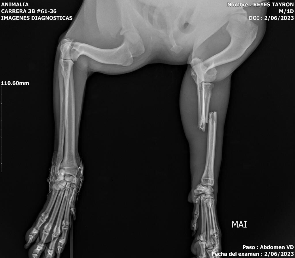 Tayron se cayó de un tercer piso y se fracturó sus patas