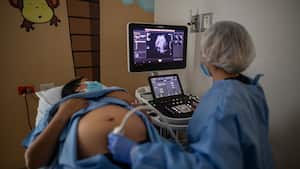 50 por ciento de los niños con cardiopatías, aproximadamente, requieren tratamiento o intervención durante el primer año de vida.