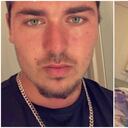 El estadounidense se ha sometido hasta el momento a dos cirugías.