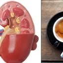 El café y su efecto en el riñón.