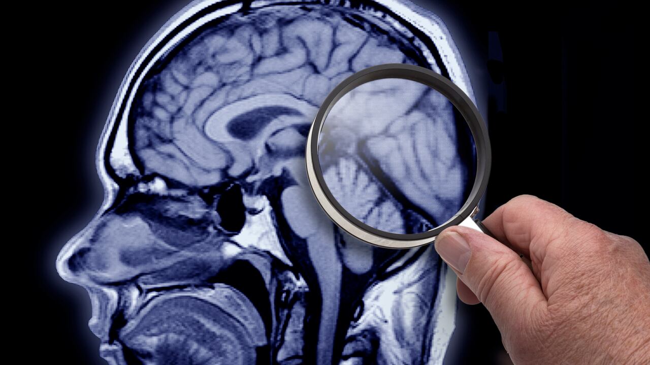 ¿Cómo fortalecer la memoria?