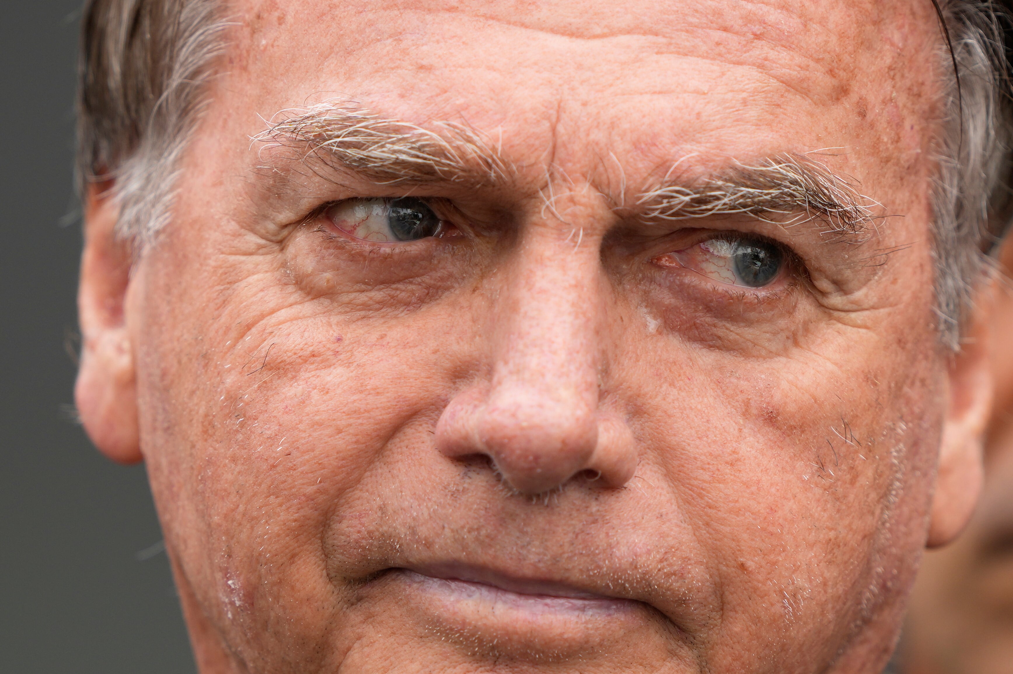 El expresidente brasileño Jair Bolsonaro, a quien se le permitió dejar temporalmente del arresto domiciliario para recibir tratamiento médico.