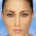 Párpados caídos, bolsas en los ojos, cuidado de la piel, belleza