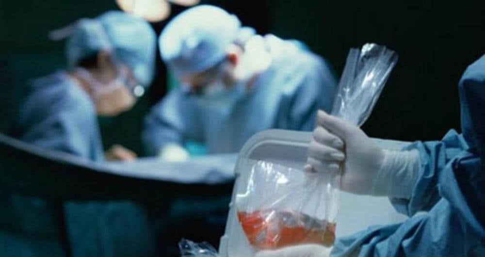 Los órganos no se guardan en bancos, deben ser trasplantados en un tiempo corto para asegurar su funcionamiento en el receptor.