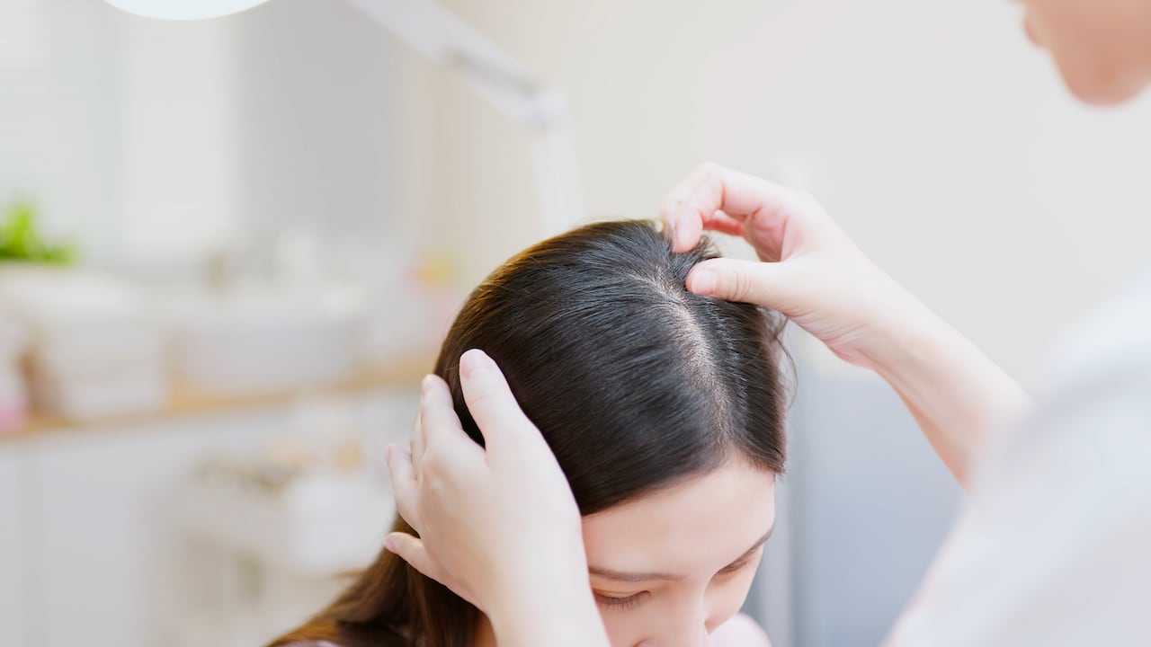 Revisión de granos en el cuero cabelludo. Imagen de referencia.