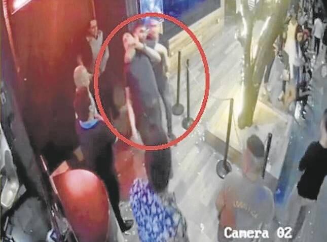 El joven sufrió múltiples fracturas en el rostro.