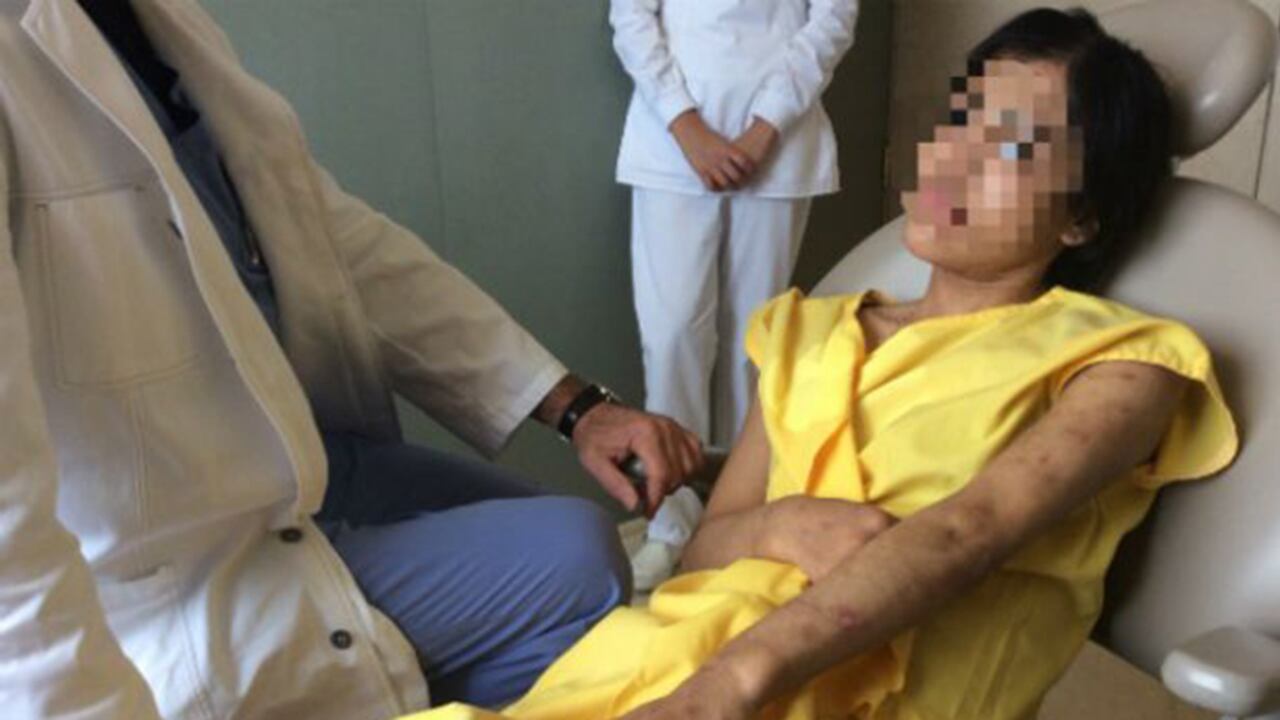 Los médicos que la han tratado aseguran que nunca vieron algo como esto. Un cuerpo de veinteañera con órganos de ochenta.