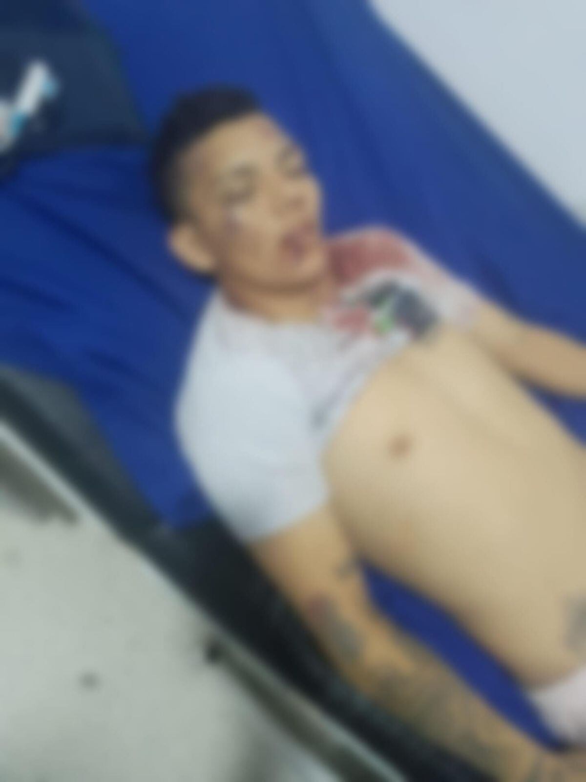 Joven murió en plena riña