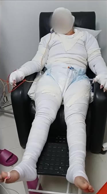 María Alejandra Ortiz, víctima de un ataque con fuego.