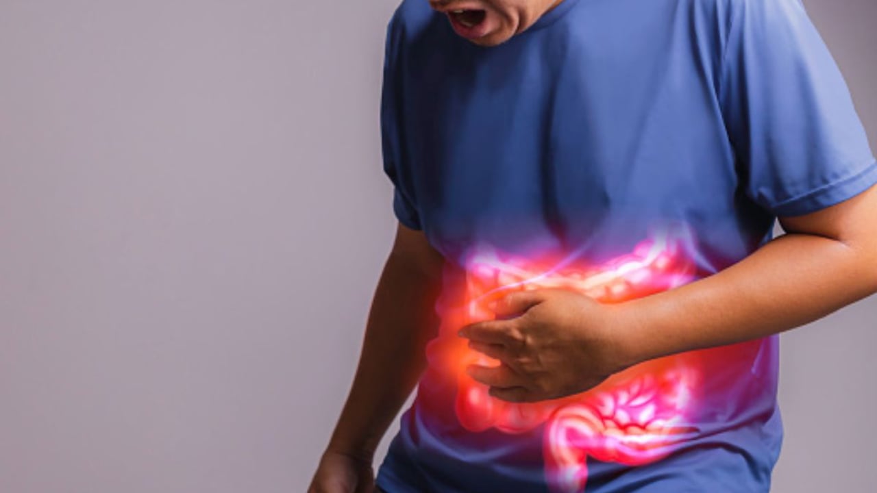 Cáncer de colon es de los más comunes.