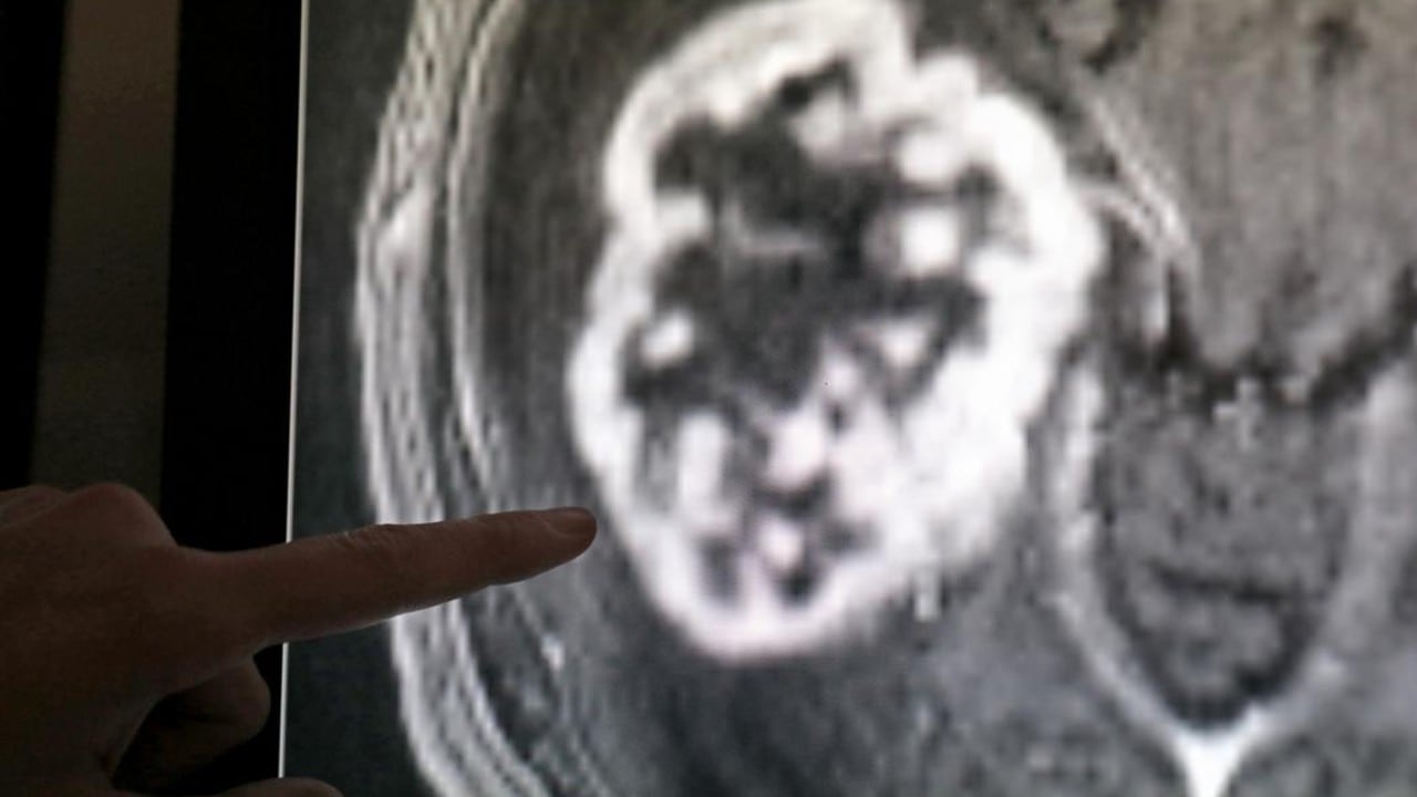 El hallazgo podría conducir a nuevos tratamientos contra el cáncer tanto para mascotas como para personas.