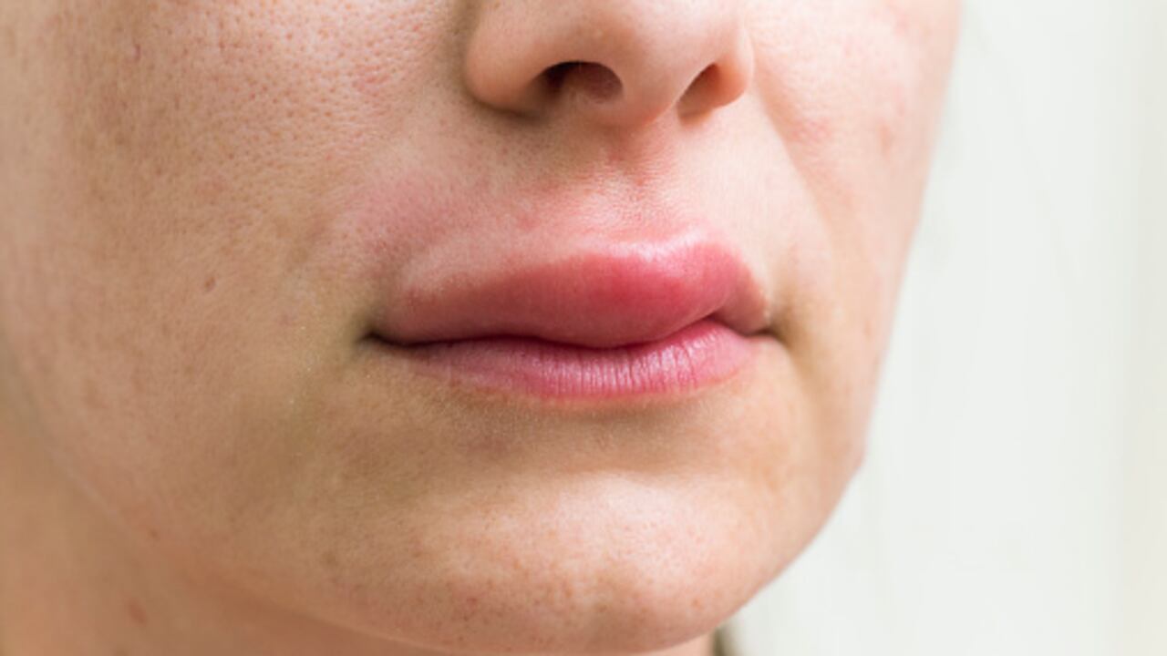 ¿Cómo rejuvenecer los labios de forma natural con remedios caseros?